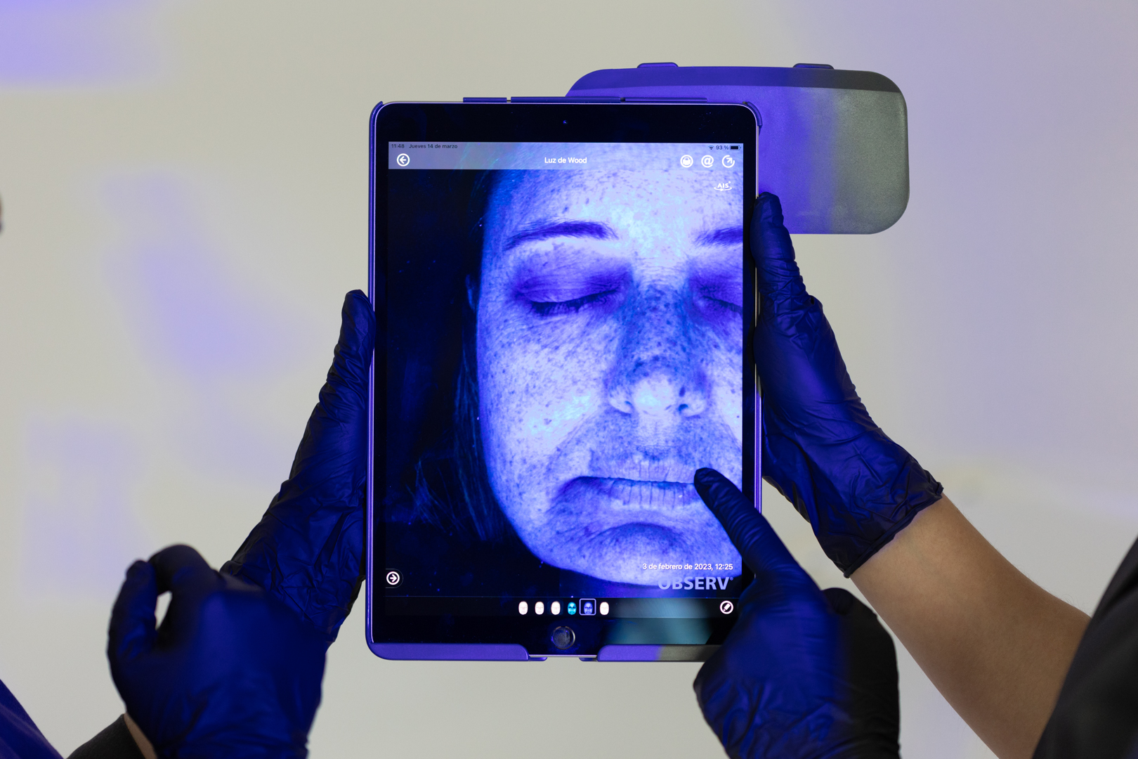 Detailed assessment of skin homostasis: bacterial load, vascularisation and ageing.