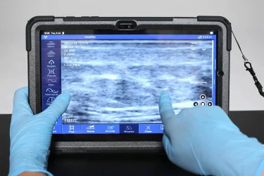 Ultrasonographic analysis of fillers stability after our treatments. 100% compatibility.